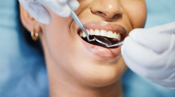 Best Emergency Dental Care for Trauma or Injury in Ipswich, SD